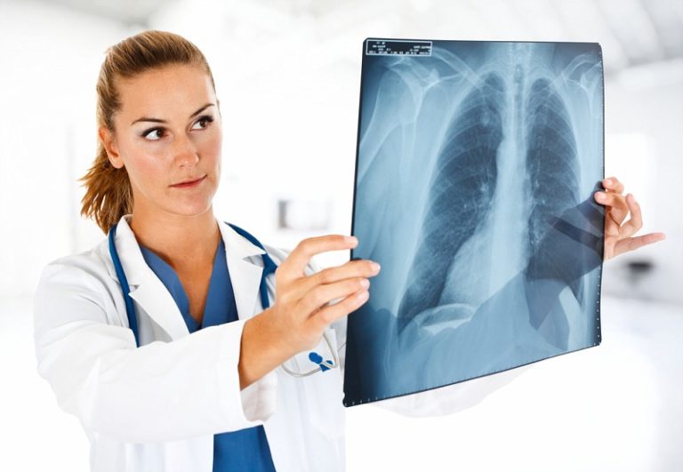 Дыхательная гимнастика при пневмонии комплекс ЛФК в