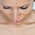 Как вывести шлаки и токсины из организма: 5 способов стать чище