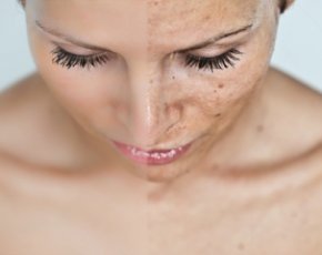 Как вывести шлаки и токсины из организма: 5 способов стать чище