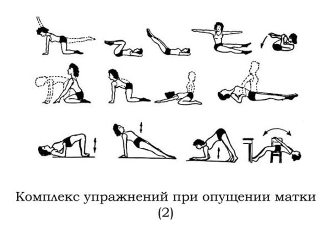 Гимнастика Кегеля при опущении матки и для ее сокращения после родов