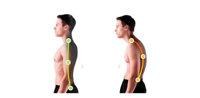 Исправление осанки в домашних условиях - лучшие методы