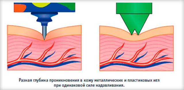 Инструкция по применению аппликатора Кузнецова: здоровье + похудение